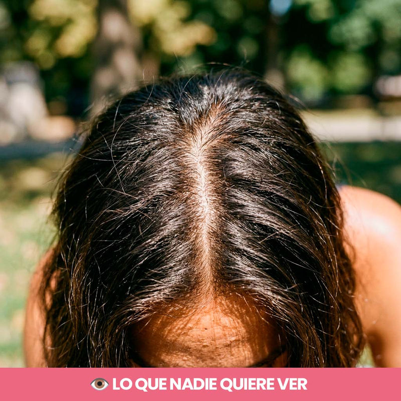 2. Tu raya se ve más ancha... y con el flash de la foto se nota el cuero cabelludo
